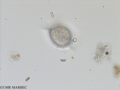 phyto/Bizerte/bizerte_bay/RISCO November 2015/Ceratocorys sp (Baie_T5-C1-Gonyaulax-14).tif(copy)_thumb.jpg